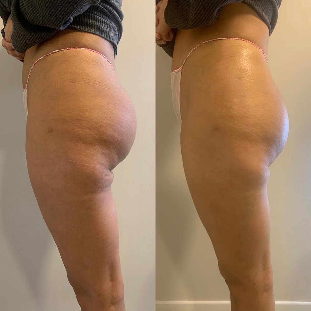 Clinic Results Gallery